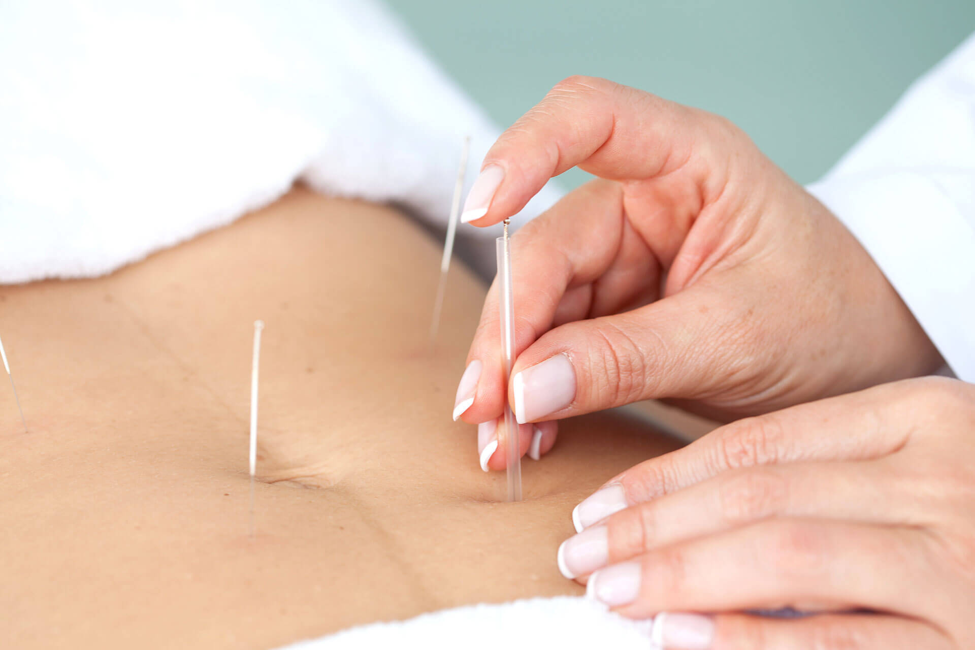 sesión Acupuntura terapia Federica Freydell